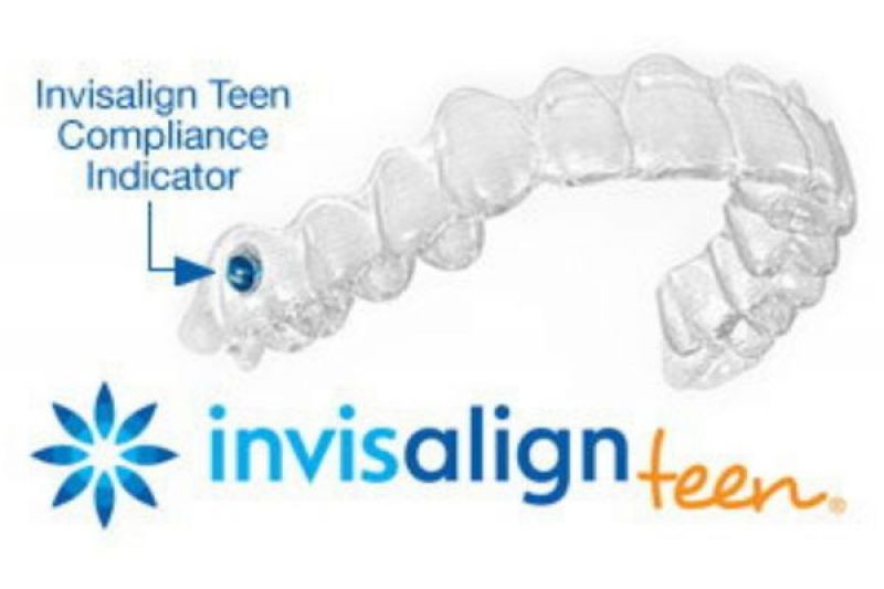 Invisalign Teen