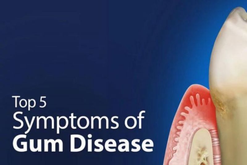 Symptoms of Gum Disease