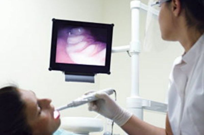 Intra Oral Camera